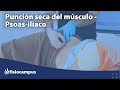 💪 PUNCIÓN SECA 💉 - Aplicación práctica de PS en el músculo Psoas iliaco