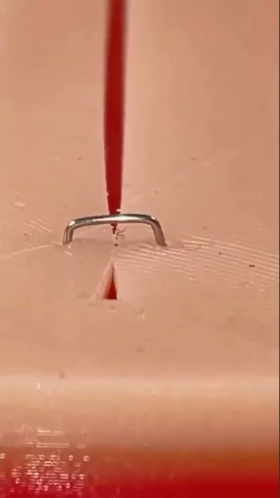 How medical staples are removed #health #youtubeshorts