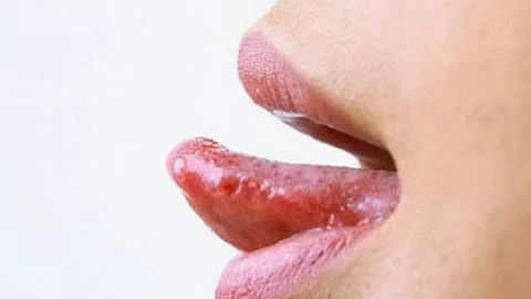 為什麼吃飯或說話的時候偶爾會咬到舌頭? 經常咬到的話可得當心啦，根本原因可能是... - 天天要聞