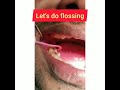 Let&#39;s do Flossing !