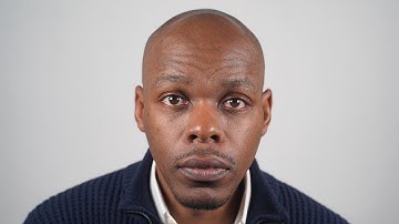 Vaughn: Before + After Scalp Micro Pigmentation at The Scalp Shop