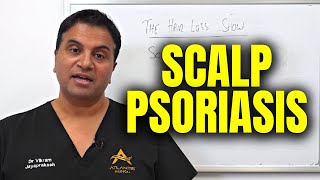 Scalp Psoriasis and Minoxidil