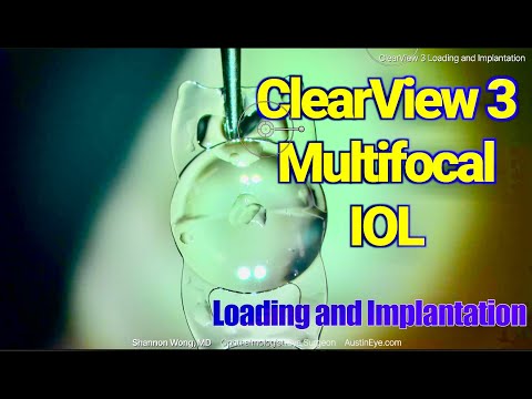 ClearView 3 Multifocal Lens - Loading and Insertion. Shannon Wong, MD.
