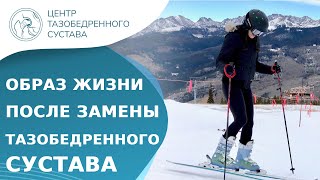 ⛷ Образ жизни после замены тазобедренного сустава. Жизнь после замены тазобедренного сустава. 18+