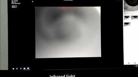 Tear Meniscus Height - KangHua Dry Eye SLM-6E