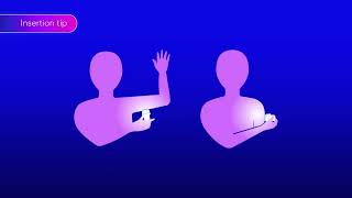 Simplera™ and Simplera Sync™ sensor insertion video