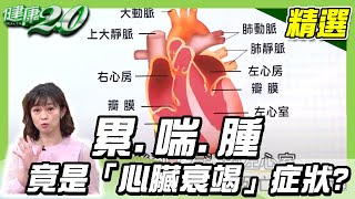 累喘腫竟是「心臟衰竭」症狀？心臟要有力，趕快練握力！健康2 0 完整版