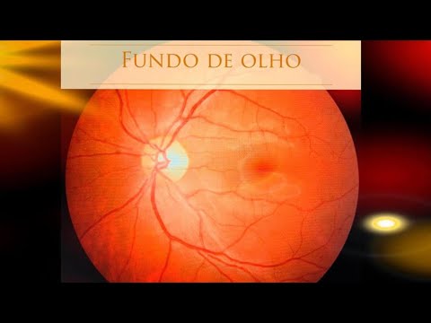 Vídeo: Como usar um oftalmoscópio (com fotos)