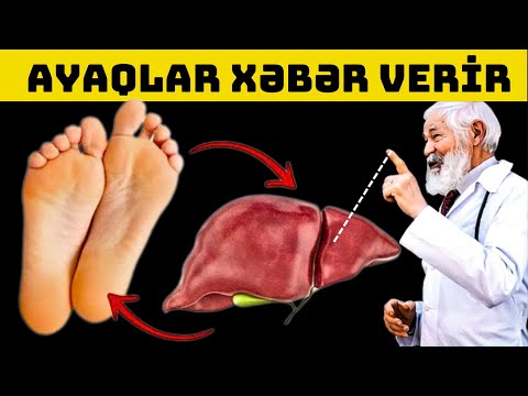 Qaraciyərin Öldüyünü Göstərən 9 Əlamət! AYAQLARA DİQQƏT