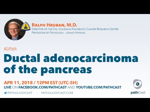 Video: Pancreatic Cancer (Adenocarcinoma) Sa Mga Aso