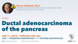 Ductal adenocarcinoma of the pancreas  Dr. Hruban (Hopkins) #GIPATH