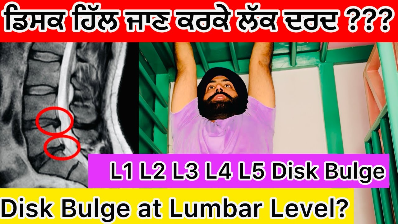Disk Bulge ?ਡਿਸਕ ਹਿੱਲ ਗਈ ਹੈ ??? L3 L4 L5 Disk Bulge Exercises Only 6 Exercises ??? 