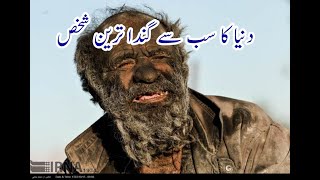 World's Dirtiest Man - He Has Not Bathed in Over 65 years