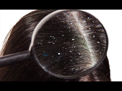 بەم پێکهاتەیە کڕێش بە سەرتەوە مەهێڵە