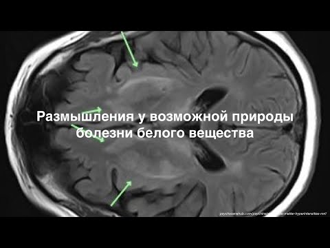 Размышления у возможной природы болезни белого вещества