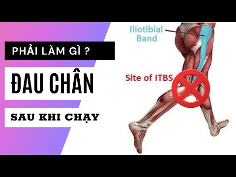 Video Căng cơ khi chạy, đau DẢI CHẬU CHÀY (IT Band Syndrome)... - youtube