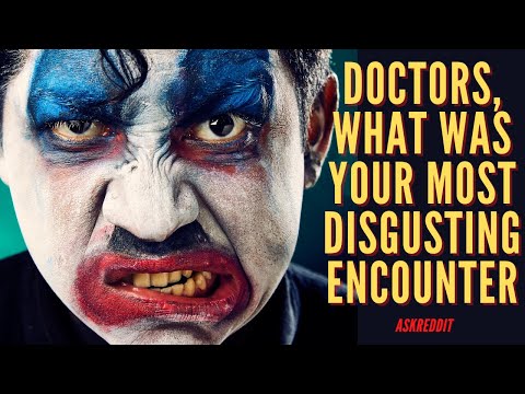 Askreddit. Doctors Share Their Goriest Medical Stories. Reddit stories