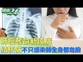 肺癌奪命新國病 結核病不只感染肺全身都危險 健康2.0