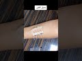 خياطه الجرح بدون غرز 