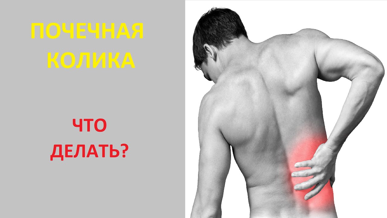 Почечная колика. Что делать? - YouTube
