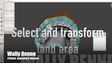 Meshmixer Immediate Denture 3D printed