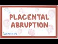 Placental abruption - causes, symptoms, diagnosis, treatment, pathology