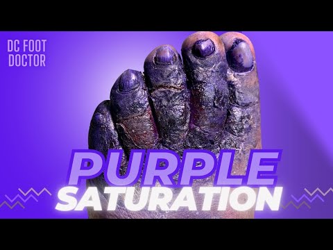 Video: Puas gentian violet nyab xeeb rau menyuam mos?