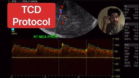 TCD Protocol (Transcranial Doppler)