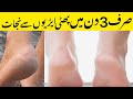 cracked heels | cracked heels home remedy | cracked heels treatment