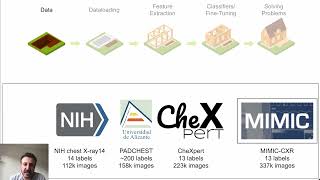 TorchXRayVision: A library of chest X-ray datasets and models screenshot 2