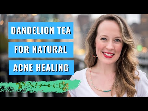 dandelion-tea-for-acne-clearing---my-secret-acne-clearing-weapon