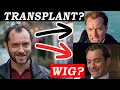 Jude Law's Hair Transformation: Transplant or Not? 🤔