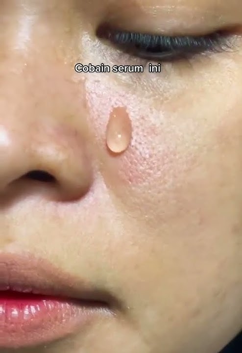 SERUM UNTUK PORI BESAR DAN KOTOR |REKOMENDASI SERUM UNTUK PORI PORI BESAR