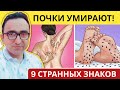 Странные признаки того, что ваши ПОЧКИ просят о помощи!