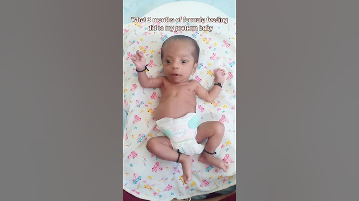 what 3 months of formula feeding did to my preemie baby 🧿🪬 #prematurebaby #nicu #nicubaby #miracle