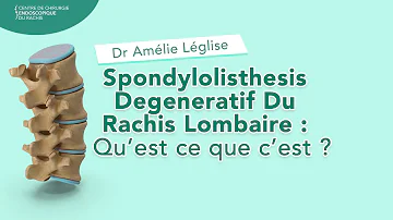 C'est quoi une spondylolisthésis ?