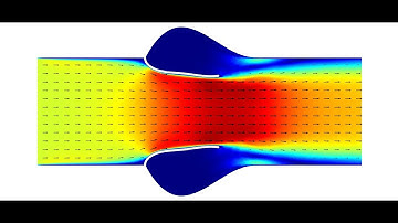 2D Fluid-Structure Interaction (FSI) Simulation of Aortic Valve / Using COMSOL Multiphysics