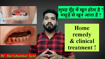 सुबह मसूड़ो से खून आता है ? Gingivitis home remedies and treatment