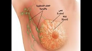 اكتشفي أعراض سرطان الثدي بنفسك