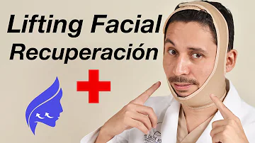 ¿Cuánto tiempo se tarda en tener un aspecto normal después de un lifting facial?