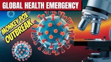 MONKEY POX ALERT! What You Need to Know Right Now! -19