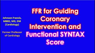 FFR for guiding coronary intervention and functional SYNTAX score