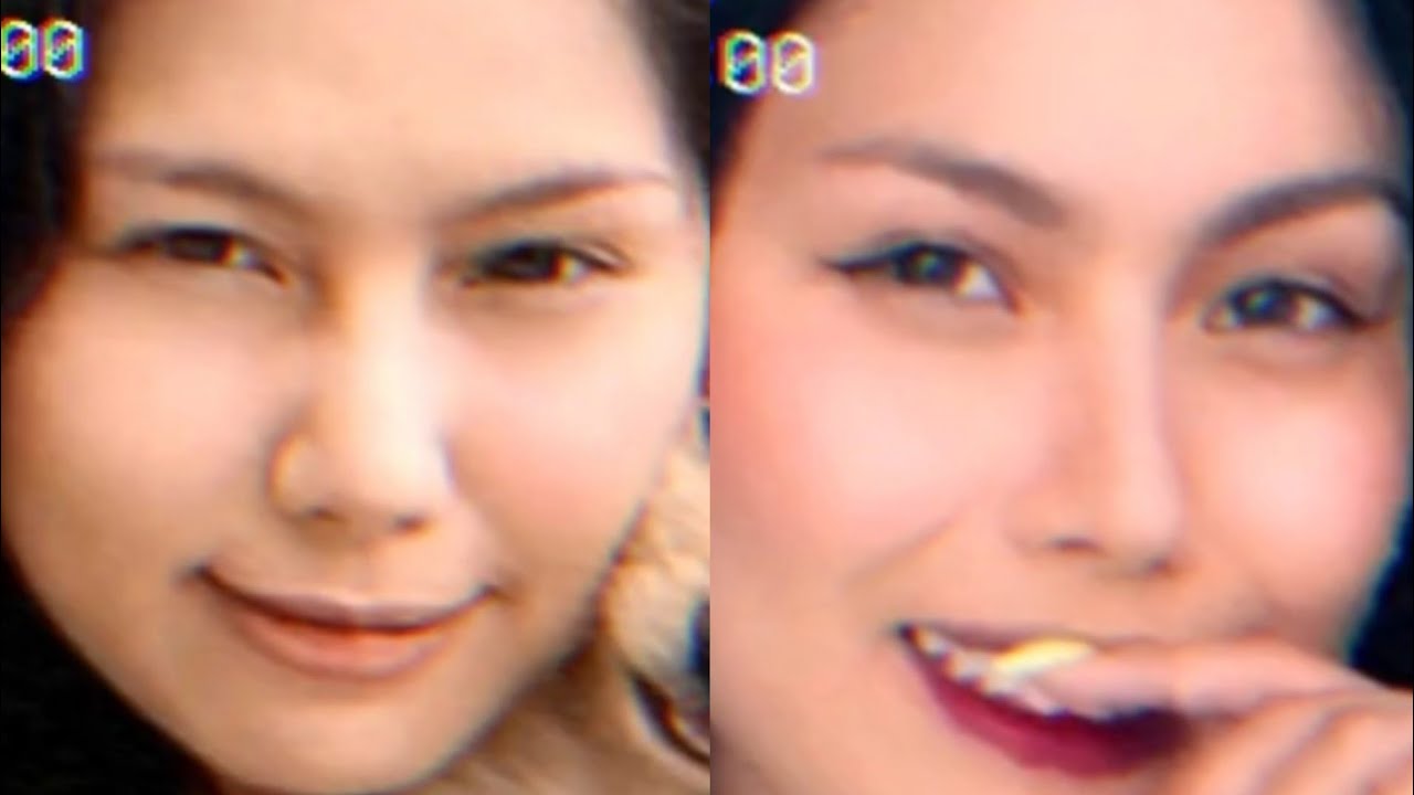 Who Is Toni Fowler? Check Out Her Before And After Plastic Surgery