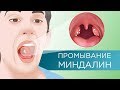 ПРОМЫВАНИЕ МИНДАЛИН – эффективно или нет?