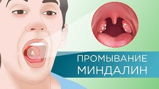 ПРОМЫВАНИЕ МИНДАЛИН – эффективно или нет?