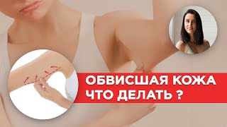 КАК ПОДТЯНУТЬ ОБВИСШУЮ КОЖУ? | Обвисшая КОЖА после ПОХУДЕНИЯ КАК ПОДТЯНУТЬ ОБВИСШУЮ КОЖУ? | Обвисшая КОЖА после ПОХУДЕНИЯ