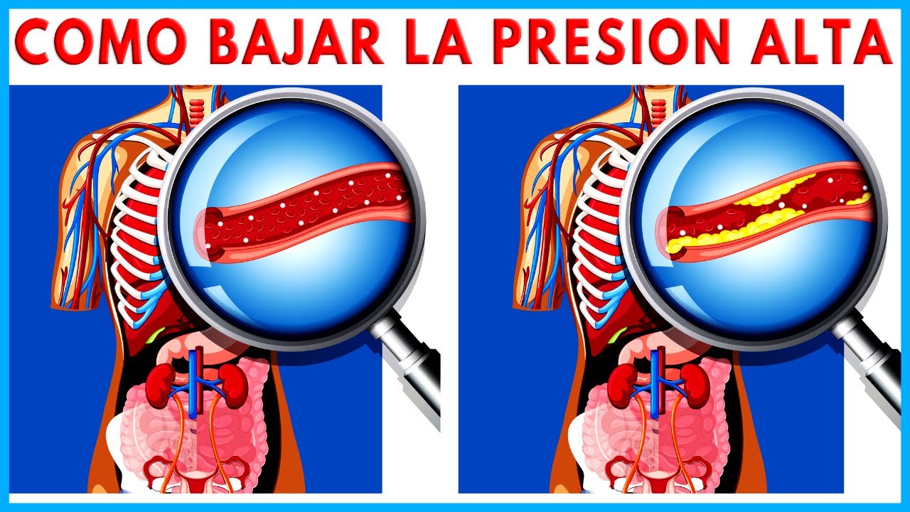 Jugo de remolacha hipertensión presión arterial