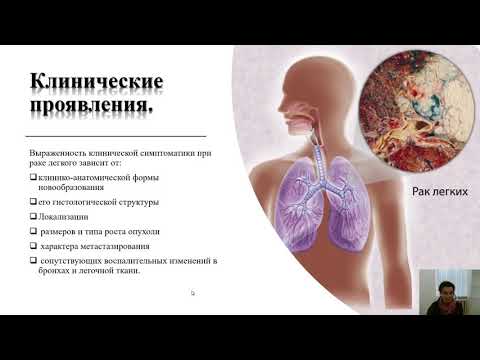 Онкология. Рак лёгкого