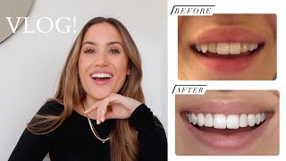 VLOG! NEW TEETH & CATCH UPS | Kate Hutchins