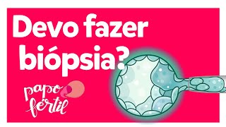 Biópsia Embrionária | Biópsia dos embriões | Papo Fértil | Dra Letícia